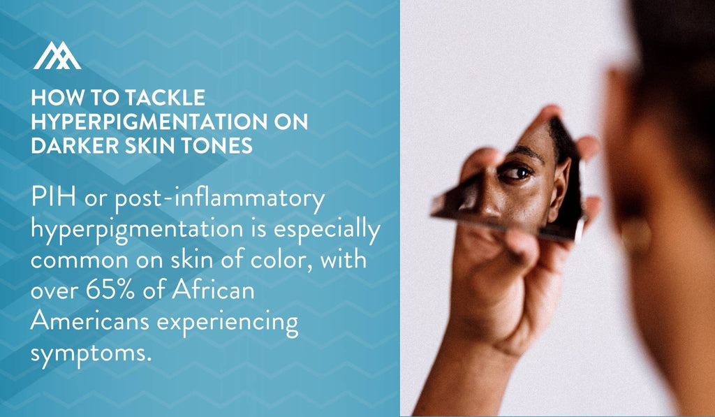 Post-inflammatory hyperpigmentation