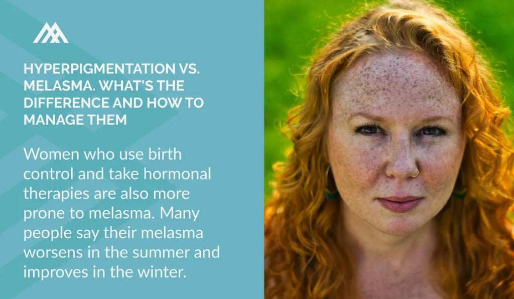 Triggers for hyperpigmentation are acne, excessive sun exposure, and injury