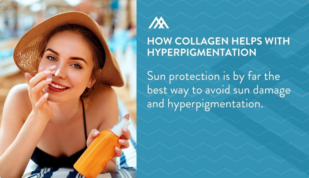 How to treat and prevent hyperpigmentation