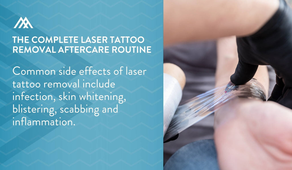 Laser tattoo removal side effects