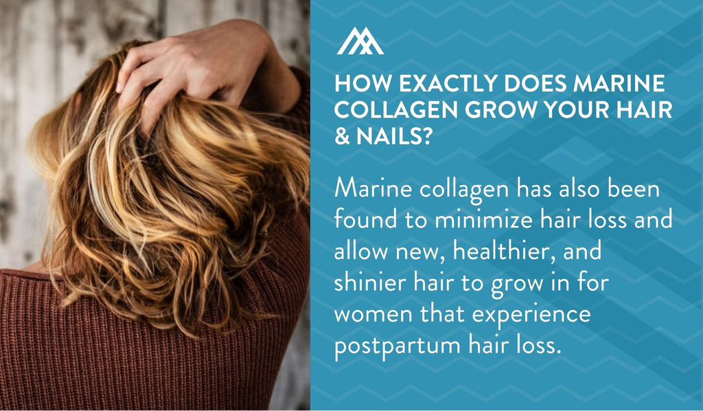 Marine Collagen Minimizes Hair Loss