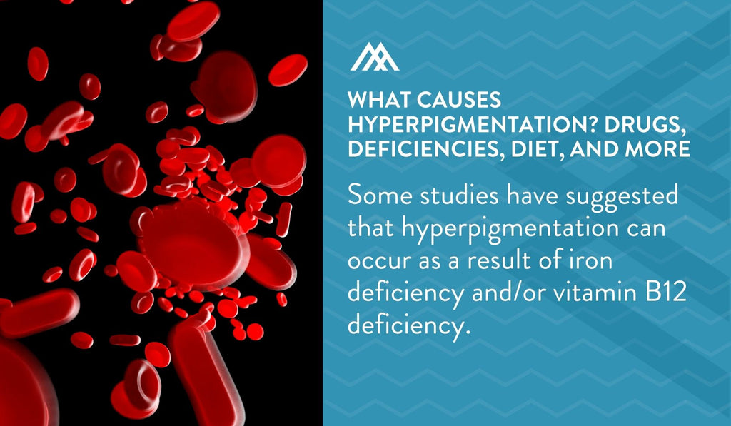 Hyperpigmentation Can Occur as a Result of Iron Deficiency