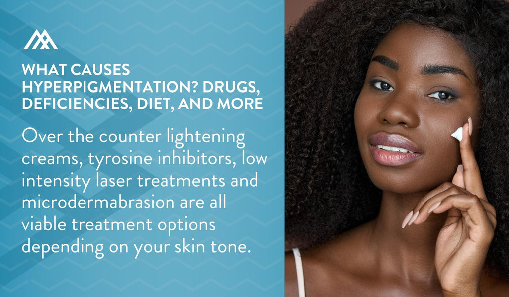 Over-The-Counter Lightening Products