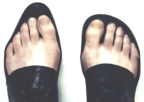 Simple Ways to Restore Natural Foot Function – Bprimal Footwear