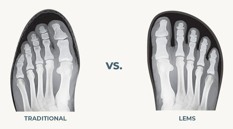 Foot shape vs Shoe shape