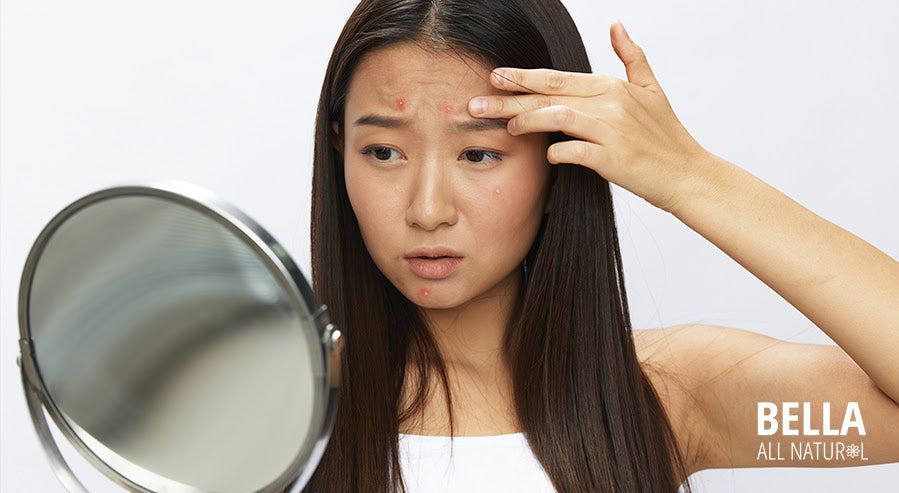 A Woman With Clear Fluid Pimples