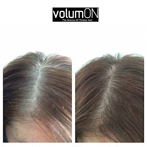 Volumon Hair Loss Concealer and Root Cover Up Kit 1