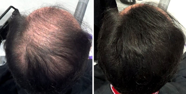 Volumon Hair Loss Hair Building Fibres - Keratin 12g 7
