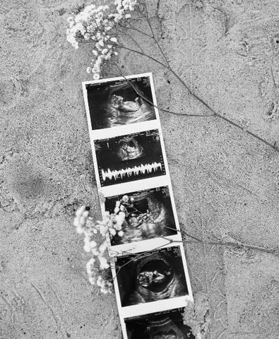 Sonogram on the beach pregnancy announcement