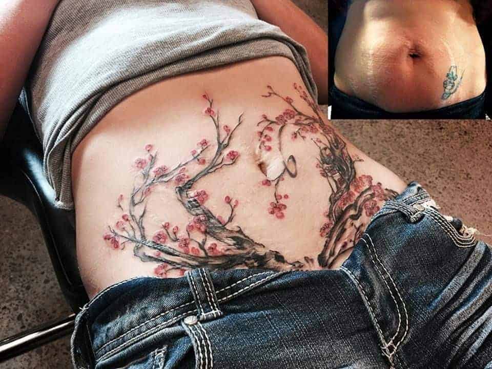 Camouflage Tattoo for Stretch Marks