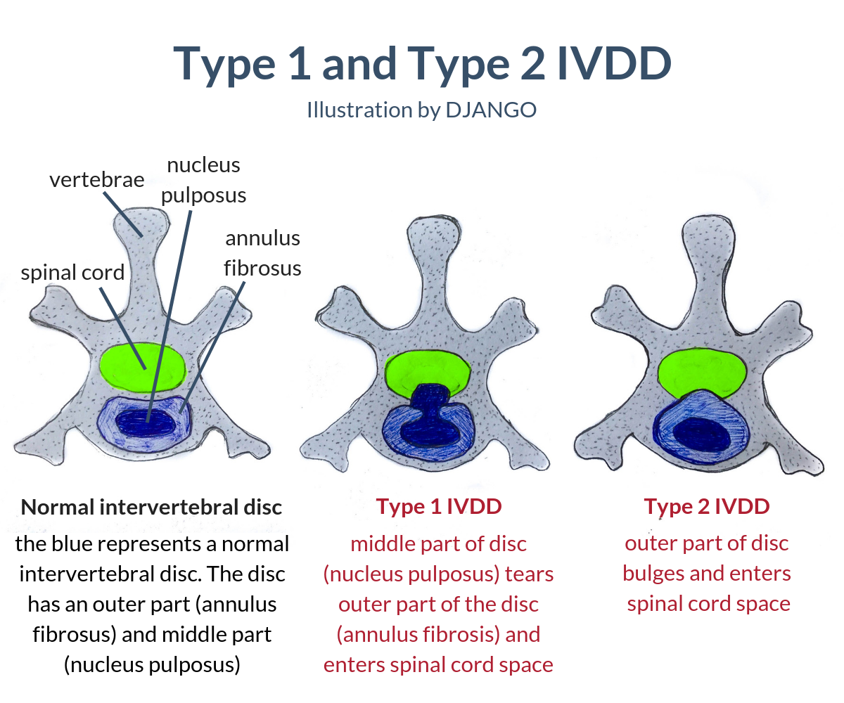 IVDD in dogs: There are two types of canine disc disease including Type 1 and Type 2