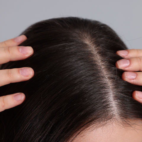 Understanding Scalp Health