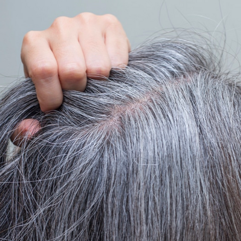 Aging Scalp