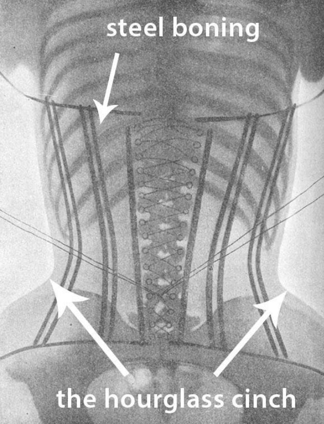 What is Corset Boning anyway? - All about corset making and corsetry  components