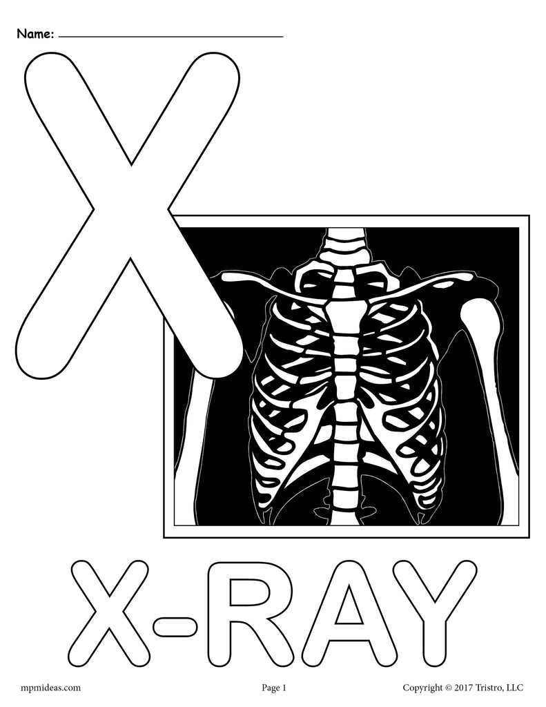 Letter X Alphabet Coloring Pages - 3 Printable Versions!