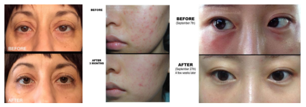 photos of women's faces using copper peptide before-and-after images