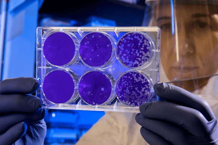 woman wearing person protective equipment holding viewing glass of bacteria culture