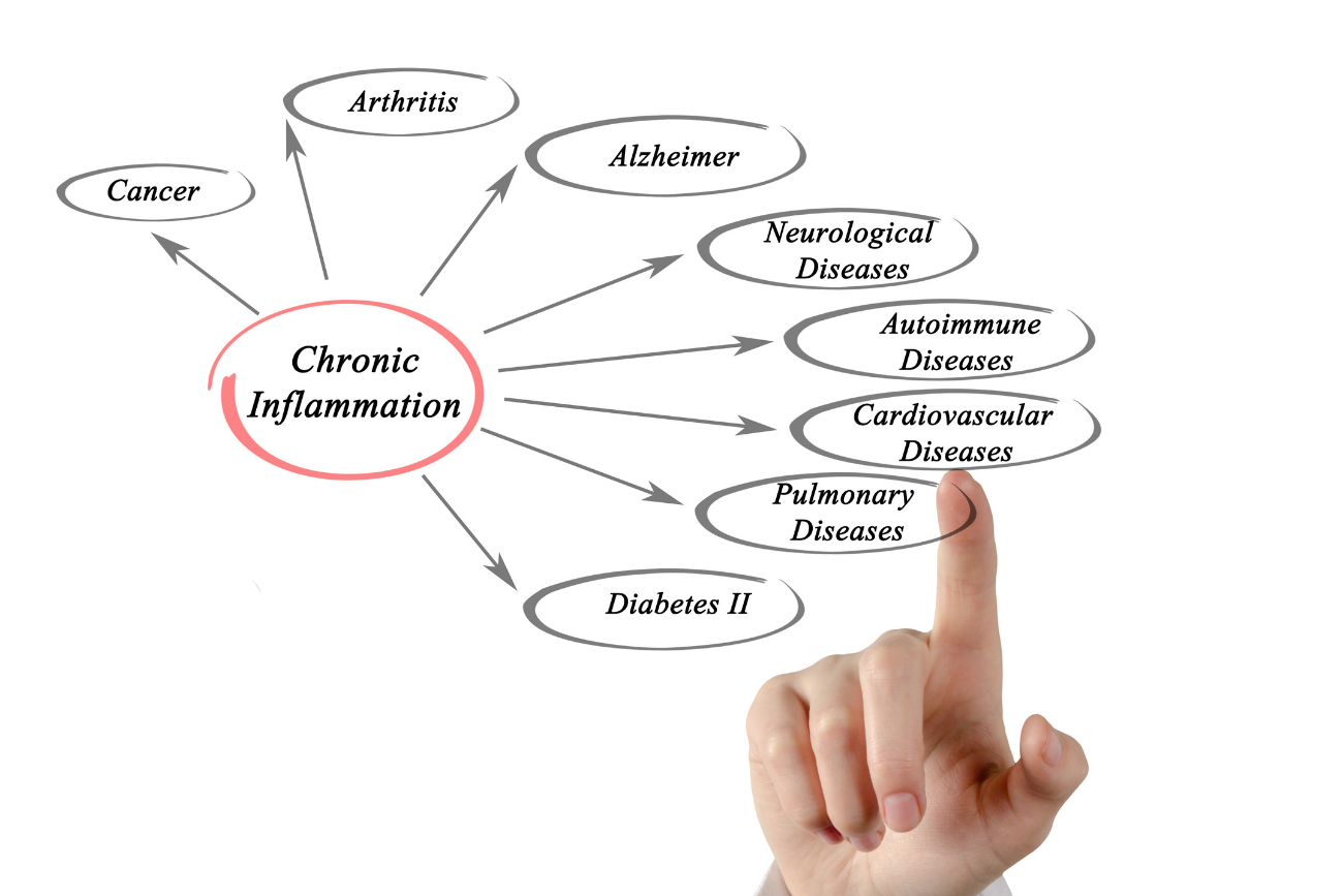 Diagram of diseases and conditions associated with chronic inflammation