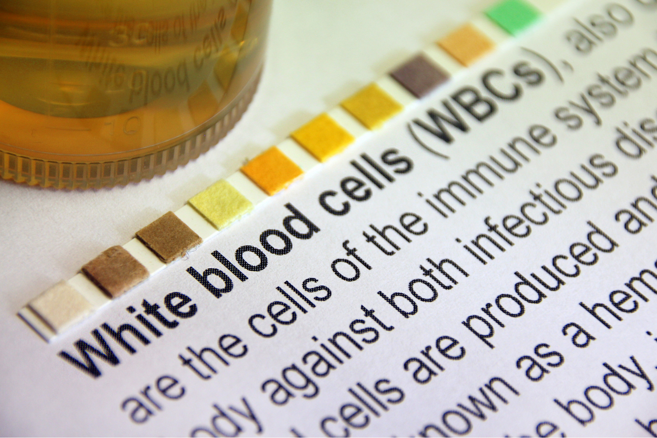 White blood cells and the inflammatory response