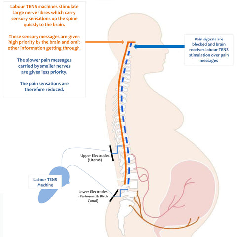 Here's the science behind how a TENS machine works – NatalCare