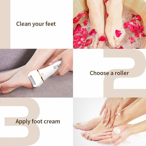 Callus Remover