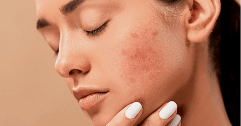 Assess Your Skin Concerns