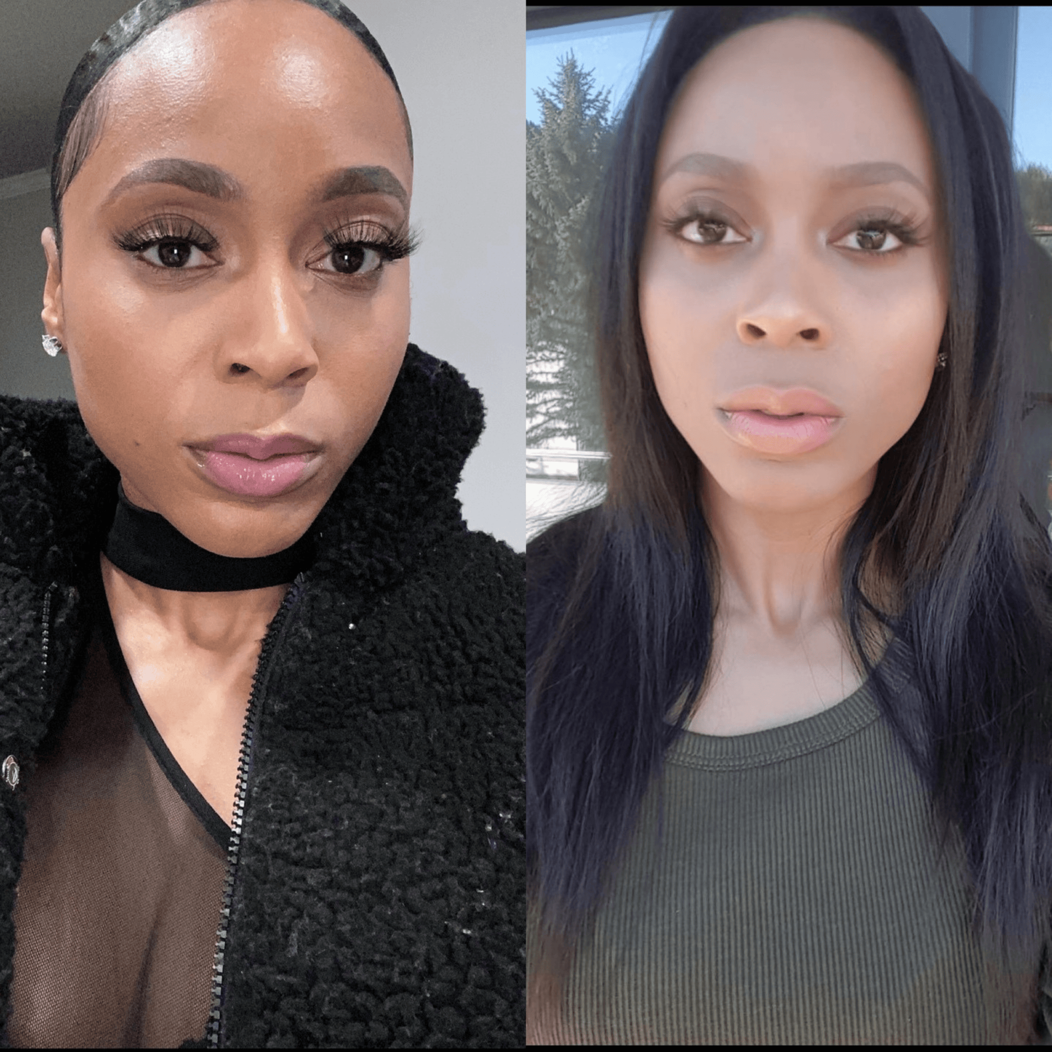 hyperpigmentation before and after.png__PID:46c1852d-6818-441f-95c2-4a98008b5ce8