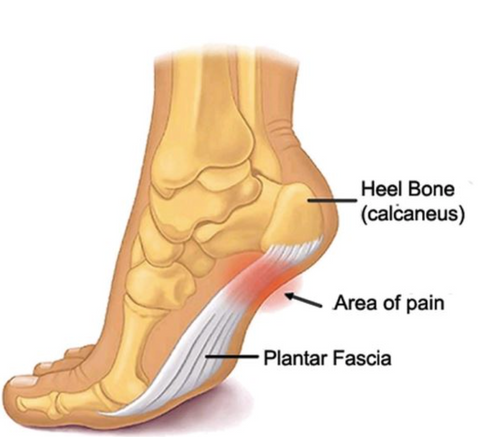 the pain area of an individual foot with its symptoms, in the style of prateep kochabua, havencore, massurrealism, petcore, graceful movement, dark beige and white, carolina herrera --ar 58:53