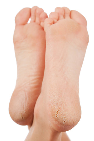 Our feet range | Dermal Therapy Singapore