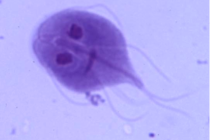 drinking-water-giardia