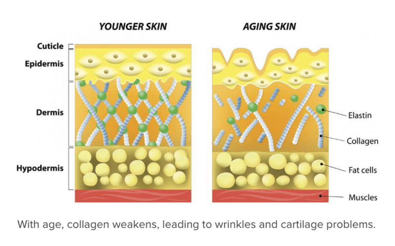 Skin Dermis