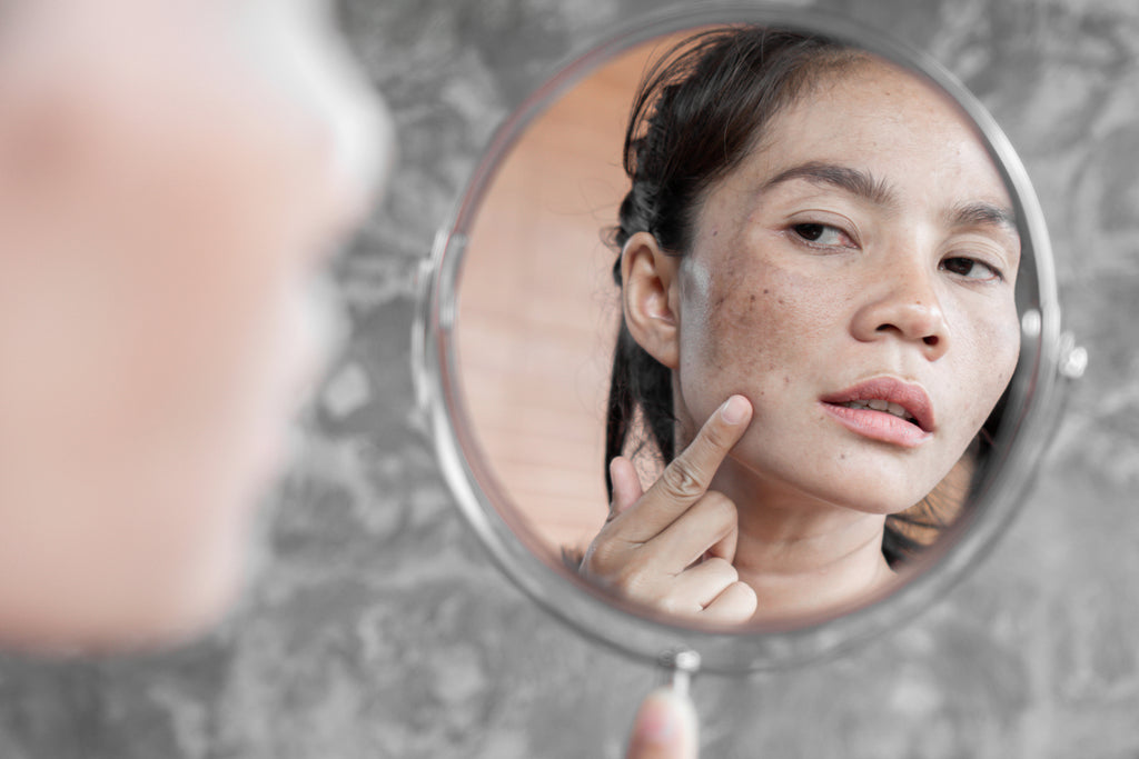 how to remove ageing spots on face skin