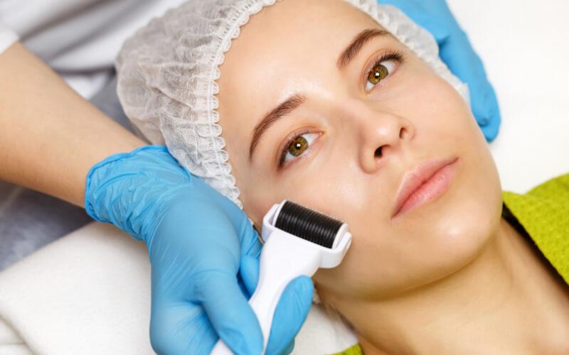 what is skin needling face