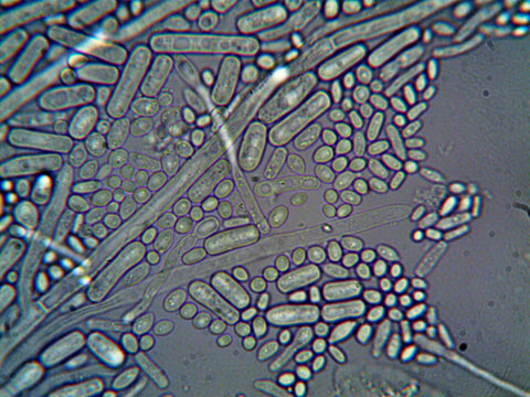 Bacterial cells under a microscope