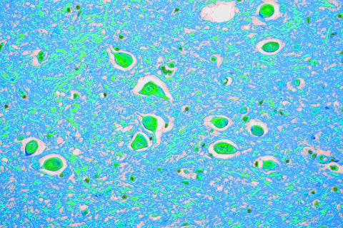 Alzheimer's cell image histology slide