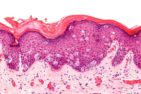 Breast cancer cell image histology slide