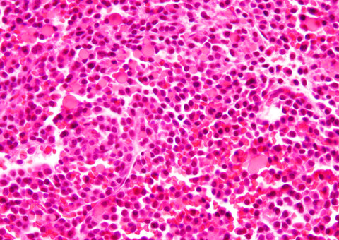 multiple myeloma cell image