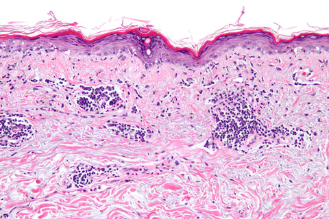 lupus histology slide