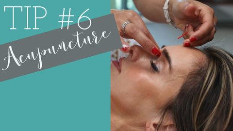 woman having acupuncture needle inserted on her forehead Tips #6 acupuncture