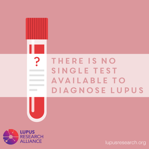 there is no single test for lupus