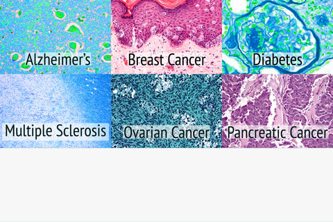 cell image histology slides of Alzheimer's, breast cancer, diabetes, multiple sclerosis, ovarian cancer and pancreatic cancer