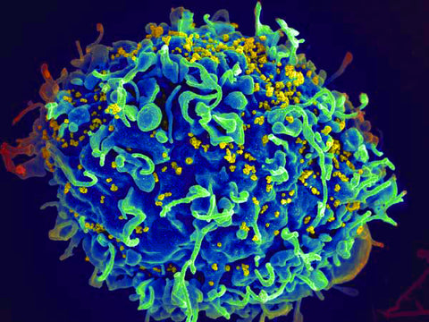 scientific image of HIV or AIDS cell