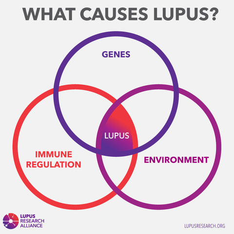 what causes lupus diagram