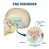TMJ masseter muscle