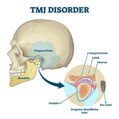 TMJ jaw pain