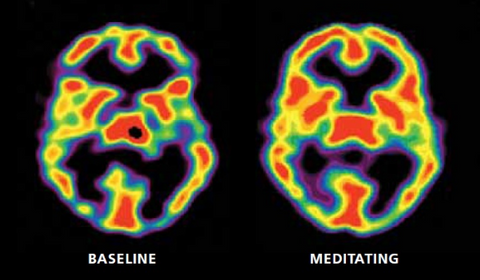 Meditación y efecto cerebral