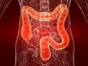 Glutamina cura el colon irritable