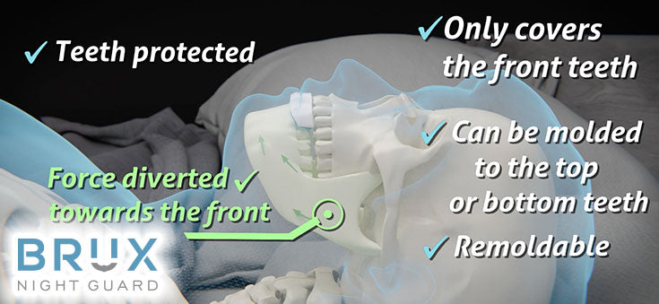 Occlusal Guard Brux Night Guard