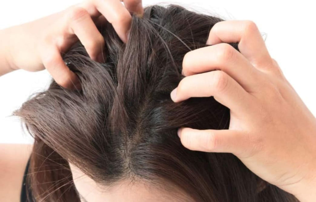 Itchy scalp Causes symptoms and treatment
