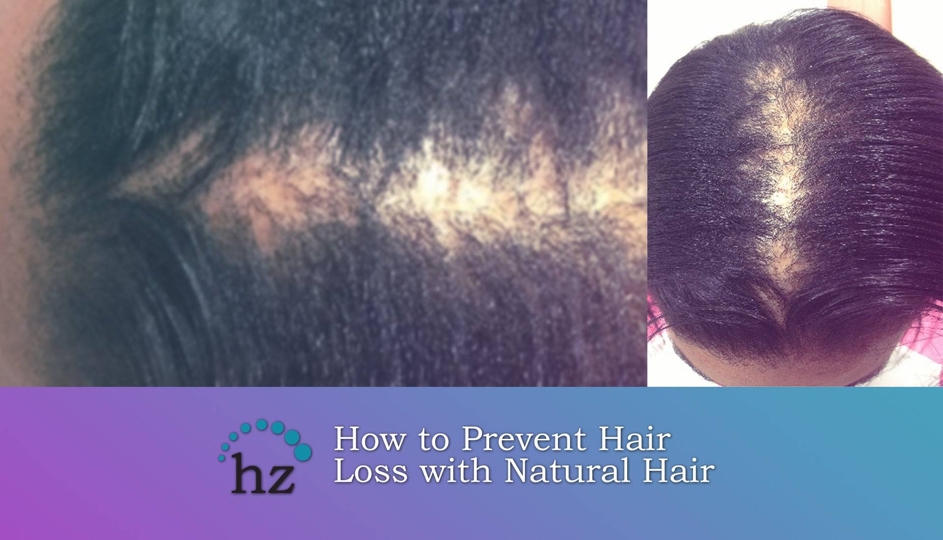 How to prevent hair loss in black women with natural hair